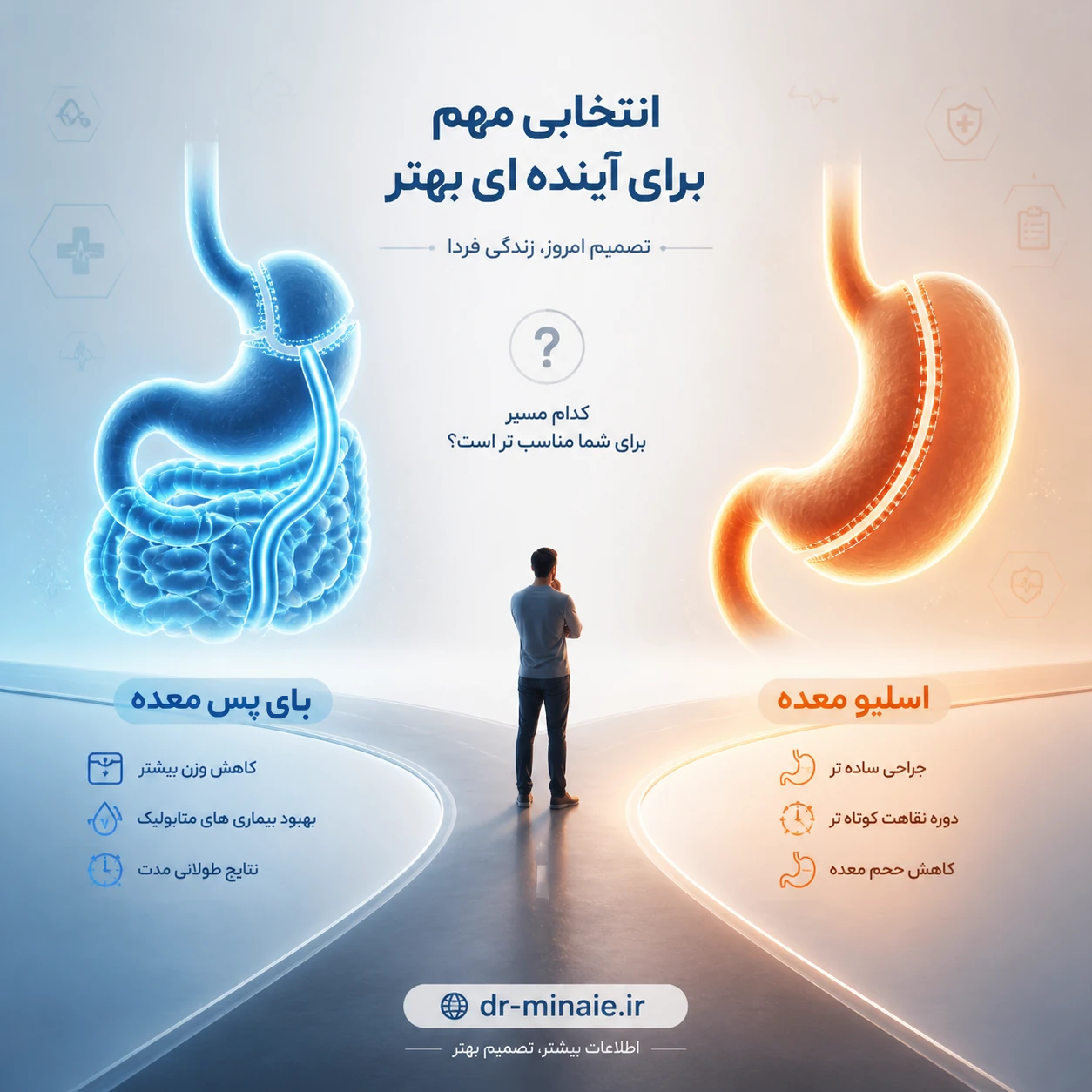 مقایسه جراحی اسلیو معده و بای پس معده